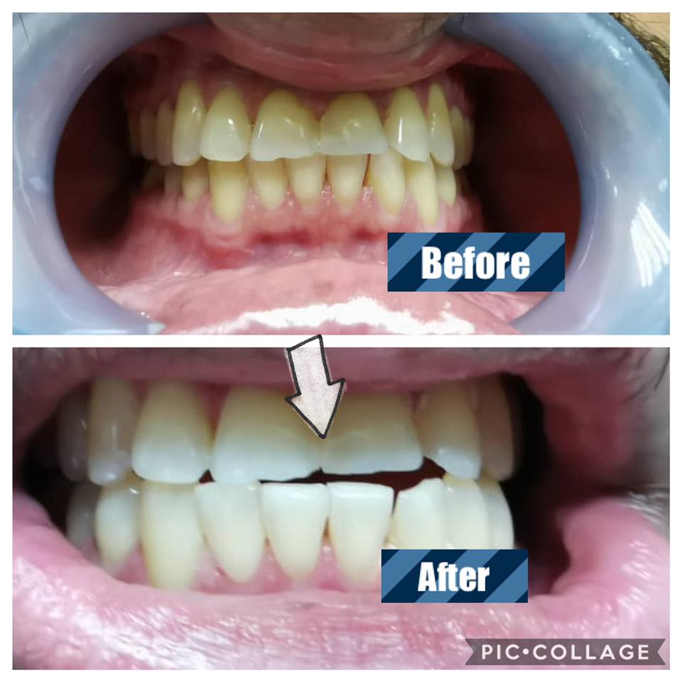 klinik pergigian mentari 2.jpg klinik pergigian mentari 2.jpg